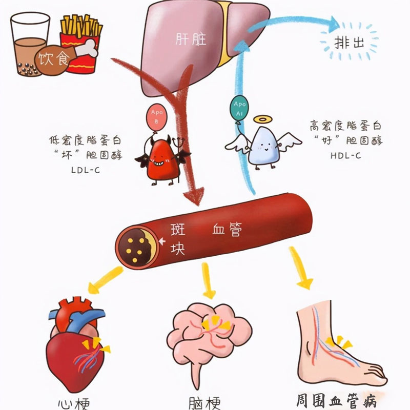 血脂四项的重要性.jpg