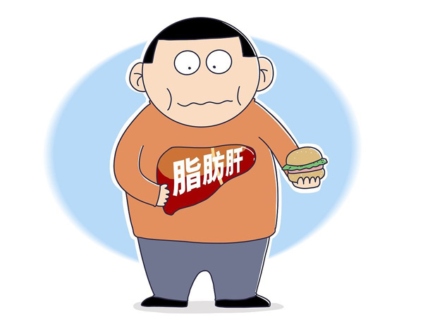脂肪肝需重视